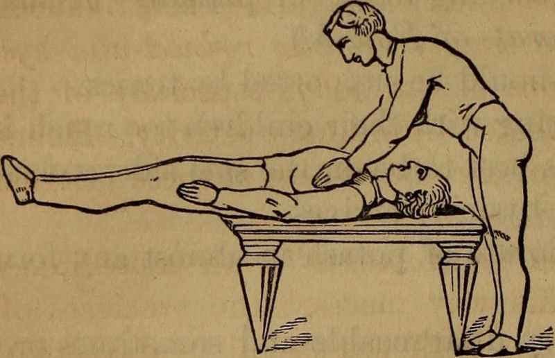 Image from page 731 of "Our home physician: a new and popular guide to the art of preserving health and treating disease; with plain advice for all the medical and surgical emergencies of the family" (1869)