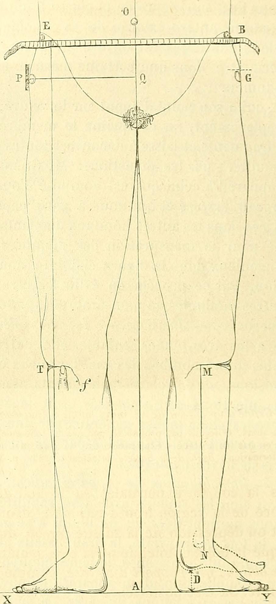 Image from page 679 of "Chirurgie journalière des hopitaux de Paris : répertoire de thérapeutique chirurgicale" (1878)